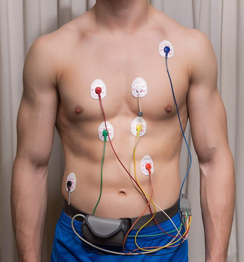 Imagen de holter de arritmias